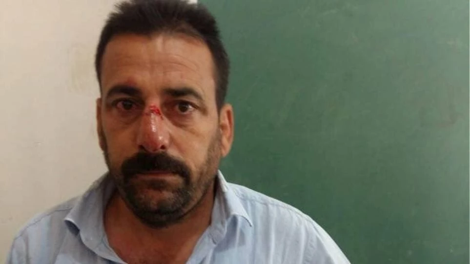 Αρχισαν τα όργανα! Βουλευτής του Ερντογάν ξυλοκοπεί παρατηρητές του φιλοκουρδικού κόμματος – Βίντεο